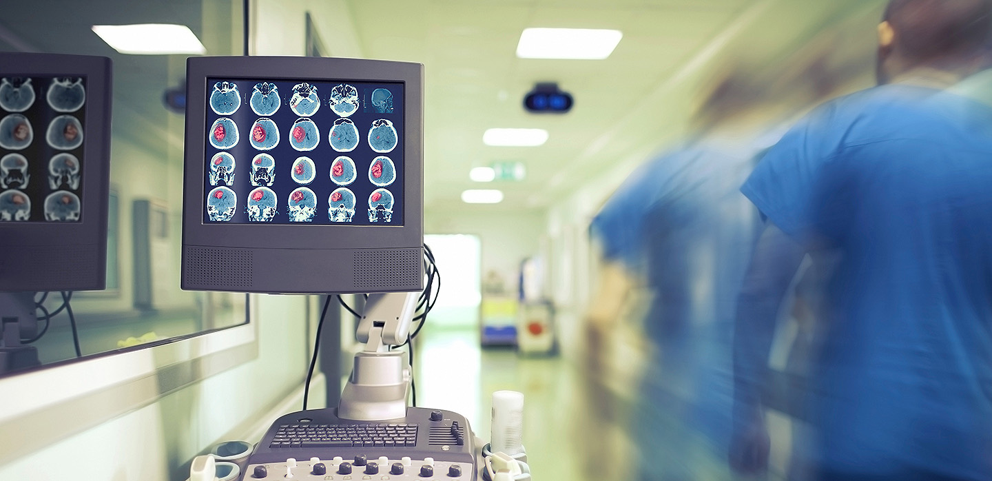 A hospital hallway with a monitor showing images of a patient's brain.