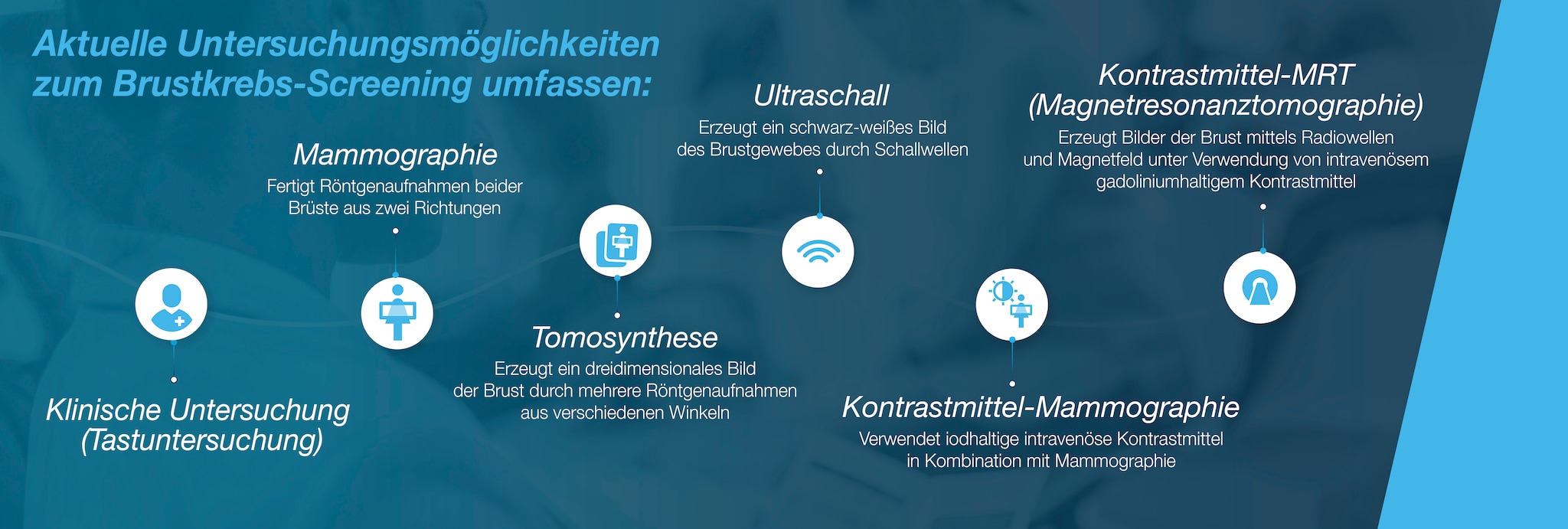 Breast cancer screening options_de