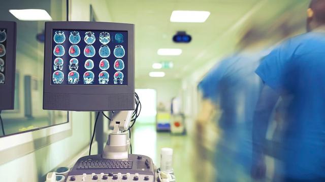 A hospital hallway with a monitor showing images of a patient's brain.