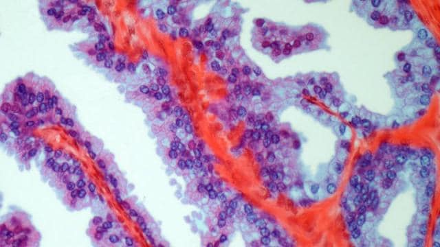 Microscopic image of tissue showing purple and blue cells with red fibrous structures.